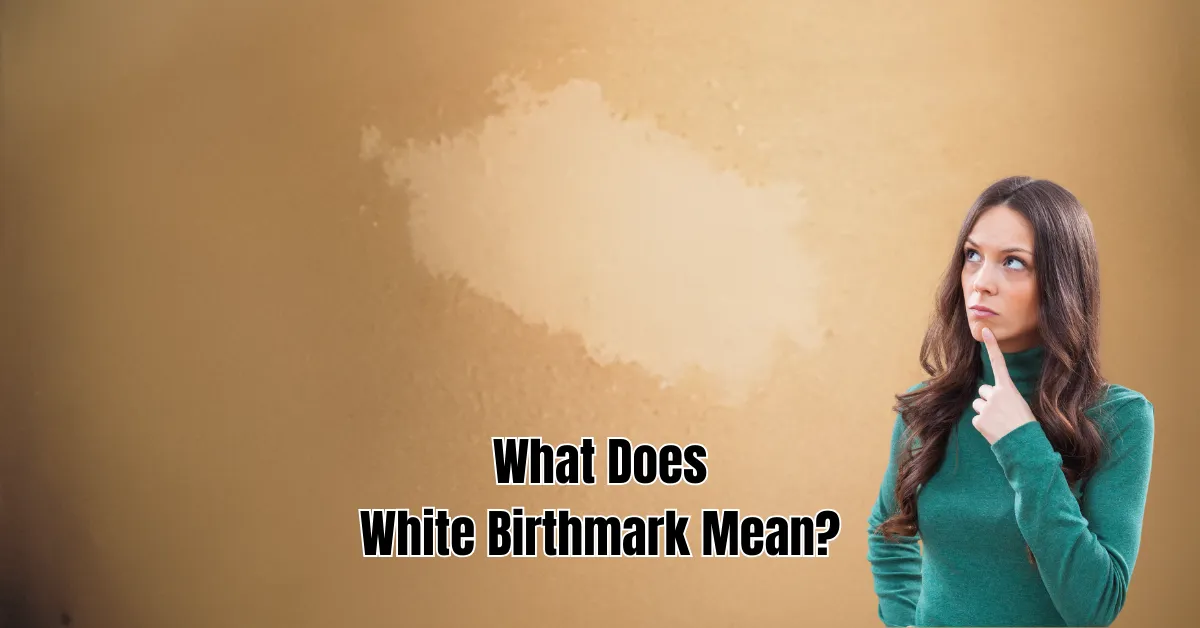 What Does White Birthmark Mean